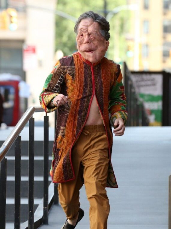 Adam Pearson A Different Man Coat